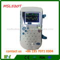 MSL620V / VP Protable Bidirectional Vascular Doppler com grande cor LCD scrren